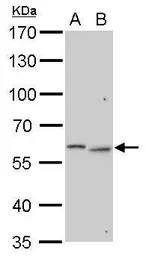 Anti-GALNS antibody used in Western Blot (WB). GTX110237