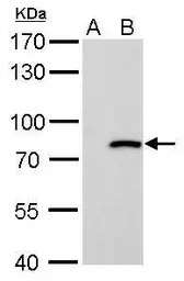 Anti-MX1 antibody [N2C2], Internal used in Western Blot (WB). GTX110256