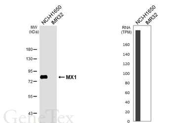 Anti-MX1 antibody [N2C2], Internal used in Western Blot (WB). GTX110256
