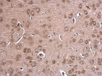 Anti-Glycine dehydrogenase antibody [N3C2-2], Internal used in IHC (Paraffin sections) (IHC-P). GTX110267