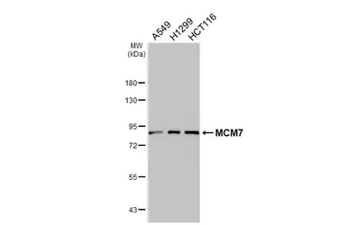 Anti-MCM7 antibody [N2C2], Internal used in Western Blot (WB). GTX110278