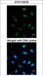 Anti-MCM7 antibody [N2C2], Internal used in Immunocytochemistry/ Immunofluorescence (ICC/IF). GTX110278