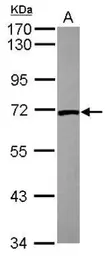 Anti-Lamin B2 antibody used in Western Blot (WB). GTX110309