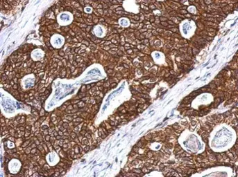 Anti-Cytokeratin 8 antibody used in IHC (Paraffin sections) (IHC-P). GTX110311