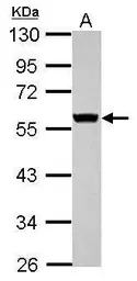Anti-Cytokeratin 8 antibody used in Western Blot (WB). GTX110311