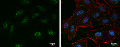 Anti-EZH2 antibody used in Immunocytochemistry/ Immunofluorescence (ICC/IF). GTX110384