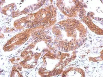 Anti-C4 / C4b antibody [N1N2-2], N-term used in IHC (Paraffin sections) (IHC-P). GTX110413