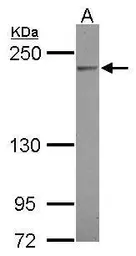 Anti-C4 / C4b antibody [N1N2-2], N-term used in Western Blot (WB). GTX110413