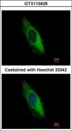 Anti-Cytokeratin 6 antibody used in Immunocytochemistry/ Immunofluorescence (ICC/IF). GTX110426