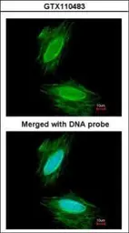 Anti-gamma Synuclein antibody used in Immunocytochemistry/ Immunofluorescence (ICC/IF). GTX110483