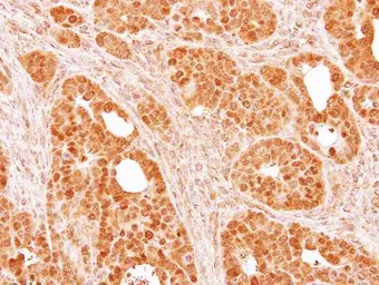 Anti-SMYD5 antibody [C2C3], C-term used in IHC (Paraffin sections) (IHC-P). GTX110518