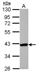Anti-SMYD5 antibody [C2C3], C-term used in Western Blot (WB). GTX110518