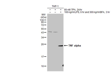 Anti-TNF alpha antibody used in Western Blot (WB). GTX110520