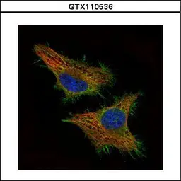 Anti-CSRP3 antibody used in Immunocytochemistry/ Immunofluorescence (ICC/IF). GTX110536
