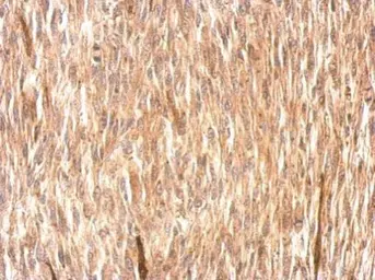 Anti-CSRP3 antibody used in IHC (Paraffin sections) (IHC-P). GTX110536