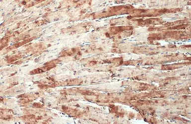 Anti-CSRP3 antibody used in IHC (Paraffin sections) (IHC-P). GTX110536