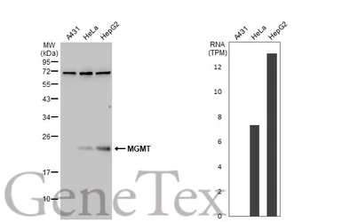 Anti-MGMT antibody used in Western Blot (WB). GTX110551