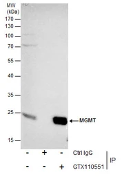 Anti-MGMT antibody used in Immunoprecipitation (IP). GTX110551