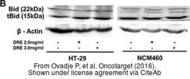 Anti-Bid antibody [N1C3-2] used in Western Blot (WB). GTX110568