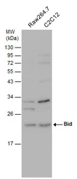 Anti-Bid antibody [N1C3-2] used in Western Blot (WB). GTX110568