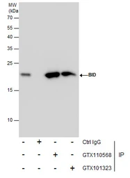 Anti-Bid antibody [N1C3-2] used in Immunoprecipitation (IP). GTX110568
