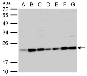 Anti-Bid antibody [N1C3-2] used in Western Blot (WB). GTX110568