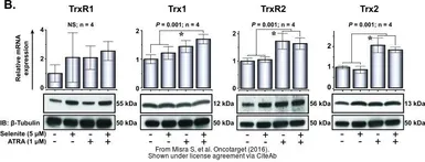 Anti-TrxR1 antibody used in Western Blot (WB). GTX110589