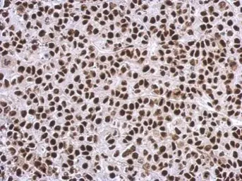 Anti-SP1 antibody used in IHC (Paraffin sections) (IHC-P). GTX110593