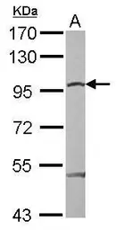 Anti-beta Catenin antibody used in Western Blot (WB). GTX110594