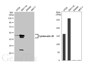 Anti-Cytokeratin 20 antibody [N2C2], Internal used in Western Blot (WB). GTX110600