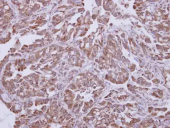 Anti-AKT1 antibody used in IHC (Paraffin sections) (IHC-P). GTX110613