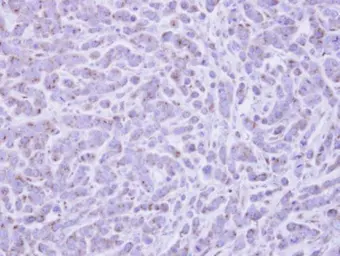 Anti-RAB6A antibody used in IHC (Paraffin sections) (IHC-P). GTX110646
