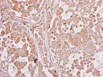 Anti-ARA9 antibody [N1C3] used in IHC (Paraffin sections) (IHC-P). GTX110665