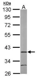 Anti-ARA9 antibody [N1C3] used in Western Blot (WB). GTX110665