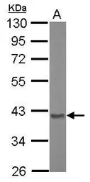 Anti-Aspartoacylase antibody used in Western Blot (WB). GTX110699