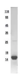 Human ATP6J protein, His tag. GTX110702-pro