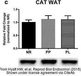 Anti-Catalase antibody used in Western Blot (WB). GTX110704