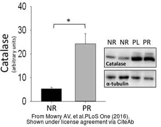 Anti-Catalase antibody used in Western Blot (WB). GTX110704