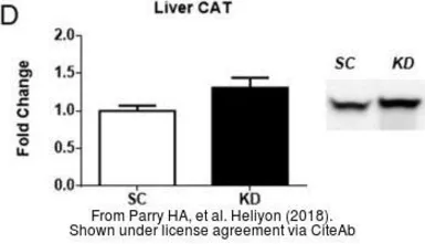 Anti-Catalase antibody used in Western Blot (WB). GTX110704