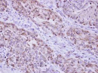 Anti-Catalase antibody used in IHC (Paraffin sections) (IHC-P). GTX110704