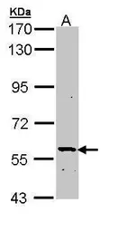 Anti-PLA2G3 antibody [C1C3] used in Western Blot (WB). GTX110780