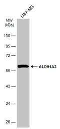 Anti-ALDH1A3 antibody [N2C2], Internal used in Western Blot (WB). GTX110784