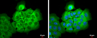 Anti-ALDH1A3 antibody [N2C2], Internal used in Immunocytochemistry/ Immunofluorescence (ICC/IF). GTX110784