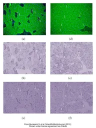 Anti-Myosin skeletal slow antibody [NOQ7.5.4D] used in IHC (Frozen sections) (IHC-Fr). GTX11083