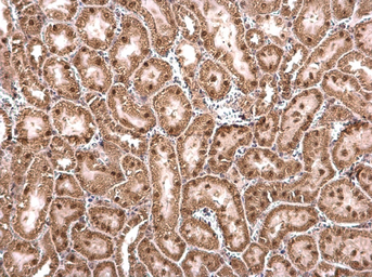 Anti-CCAR1 antibody used in IHC (Paraffin sections) (IHC-P). GTX110892
