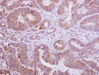 Anti-Gemin 3 antibody [N3C2], Internal used in IHC (Paraffin sections) (IHC-P). GTX110962