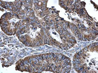Anti-SLC25A6 antibody used in IHC (Paraffin sections) (IHC-P). GTX110983