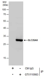 Anti-SLC25A6 antibody used in Immunoprecipitation (IP). GTX110983