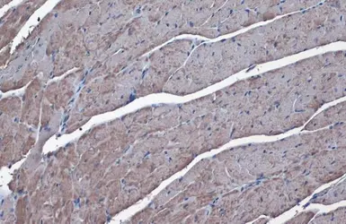 Anti-SLC25A6 antibody used in IHC (Paraffin sections) (IHC-P). GTX110983