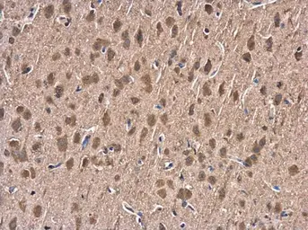 Anti-Hsp70 antibody used in IHC (Paraffin sections) (IHC-P). GTX111088